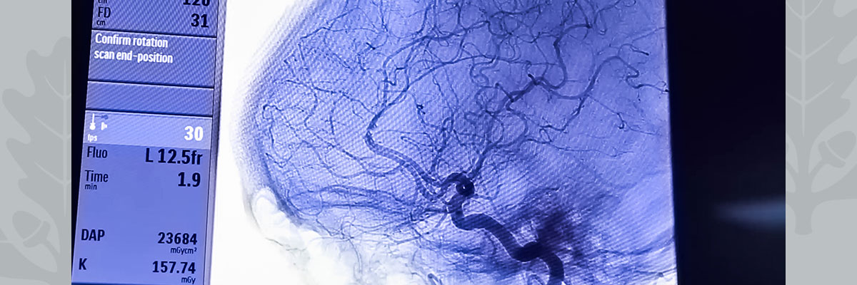 brain image showing vascular properties